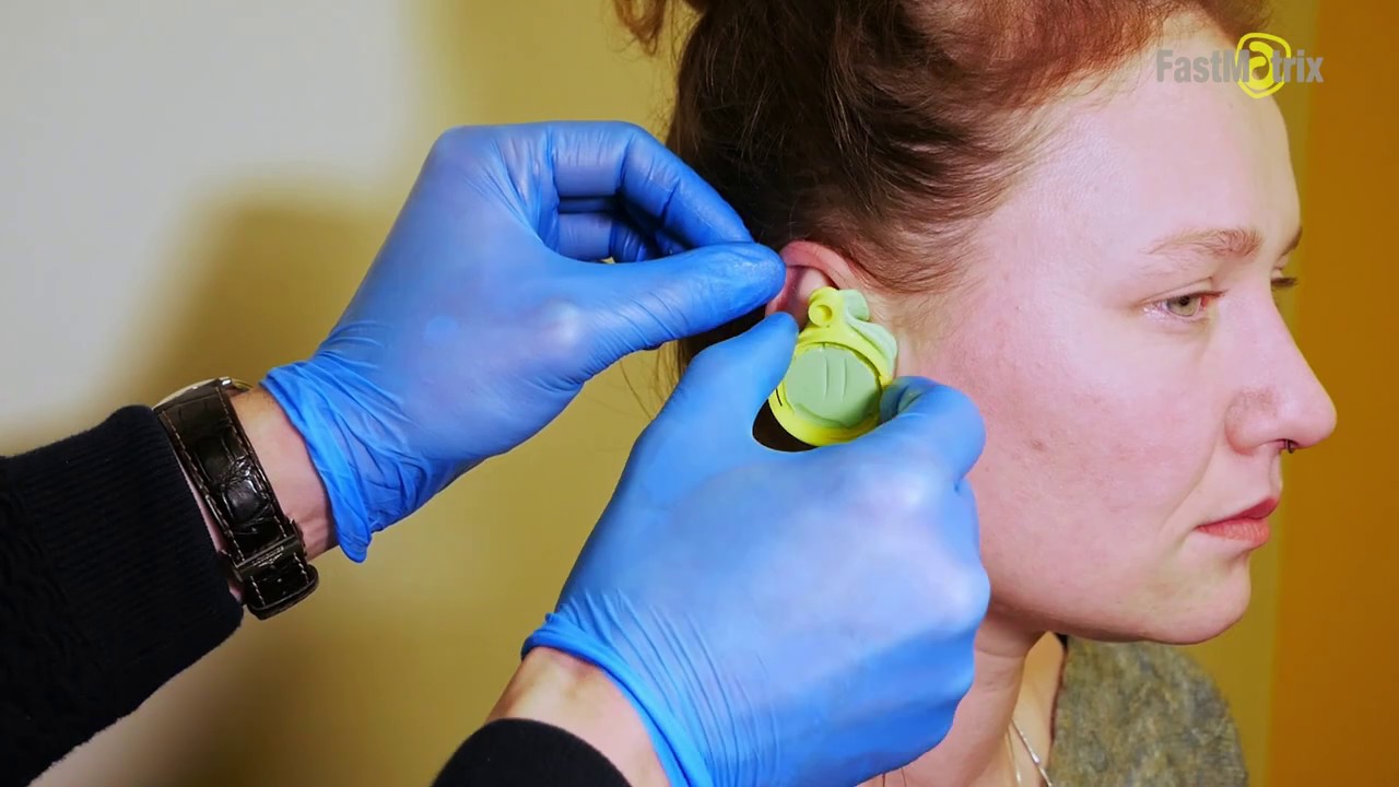 Prise d’empreinte pour bouchon d’oreille moulé sur mesure